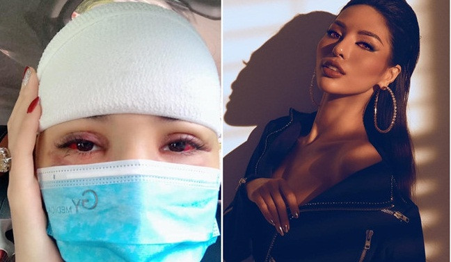 Nguoi mau Kha Trang bi tai nan, tu mau dau gio ra sao?