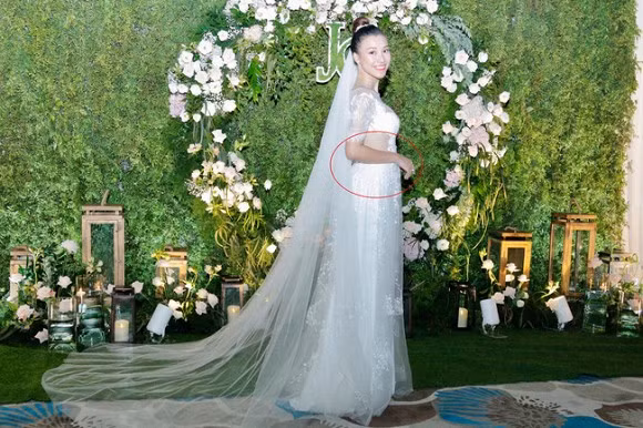 A hau Hoang Oanh dinh nghi van mang thai vi lo bung to bat thuong-Hinh-2