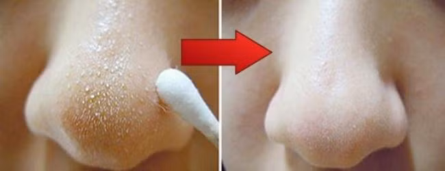 Hoc ngay cac meo lam dep tu sao Hollywood de co lan da khoe dep, lang min-Hinh-2