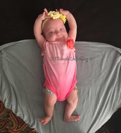  4 bé thuộc 2 cặp song sinh cùng trứng, 2 cặp này “giống nhau như đúc”. Tỷ lệ này vô cùng hiếm, chỉ chiếm 1/1.000.000 trường hợp. Ảnh: Bé Esme nặng 4,3 kg.