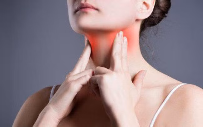 Hóa trị là phương pháp điều trị ung thư hạch cổ chủ yếu.