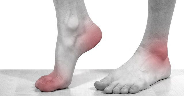 2. Tê chân bất thường: Nếu bạn để chân ở một vị trí lâu, không cử động hoặc chân bị đè lên trong một khoản thời gian thì sẽ có hiện tượng tê chân, đây là biểu hiện bình thường, chỉ cần cử động nhẹ một chút là sẽ đỡ hơn.