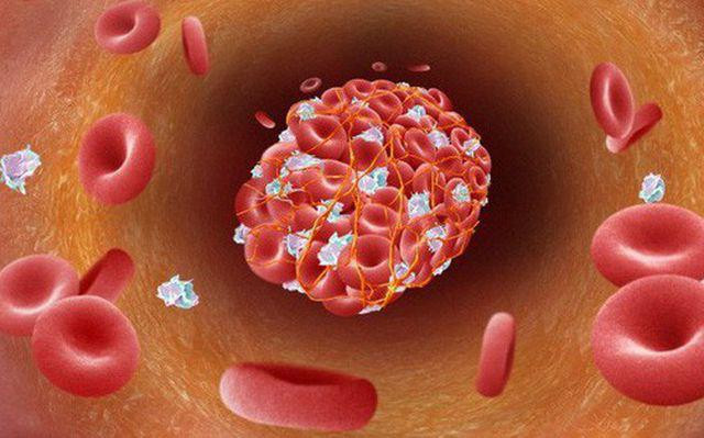 Biểu hiện của việc mạch máu bị tổn thương, lão hóa và tắc nghẽn cũng xuất hiện trên bàn chân, nếu để ý bạn sẽ thấy. Vì vậy, nếu thấy bàn chân có 2 hiện tượng này, lập tức đi khám để biết đúng bệnh, chữa trị kịp thời.