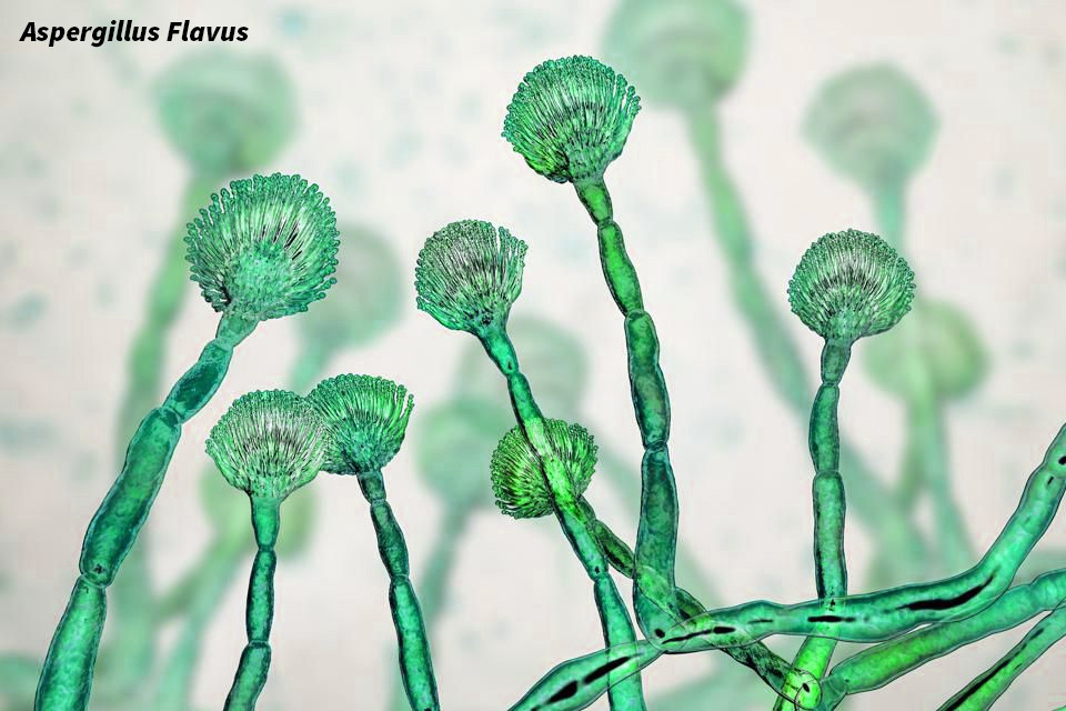 Tuy vậy, không ngửi thấy mùi hôi thối, cô Trương cho rằng trứng vẫn ăn được nên dùng nấu ăn bình thường. Cứ thế, những vi khuẩn độc hại xâm nhập vào cơ thể cô Trương, làm tăng gánh nặng cho gan, khiến gan bị tổn thương.