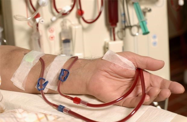 6. Sưng nề toàn bộ cơ thể: Bệnh nhân mắc bệnh thận hư thường có triệu chứng sưng phù toàn thân, nguyên nhân là do chức năng thận suy giảm, không thể thải kịp thời lượng nước dư thừa trong cơ thể ra ngoài. Nhìn chung, triệu chứng ban đầu chủ yếu là sưng mí mắt, mắt cá chân.