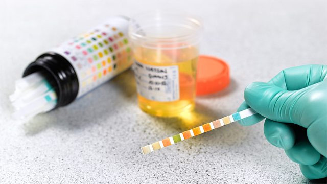 Sử dụng các loại thuốc hàng ngày như nitrofurantoin và đại hoàng trong thời gian dài cũng có thể khiến nước tiểu có màu nâu. Lúc này, hãy tìm đến sự tư vấn của bác sĩ chuyên khoa thận, khám tổng thể để tìm ra nguyên nhân cụ thể, có phương pháp điều trị.