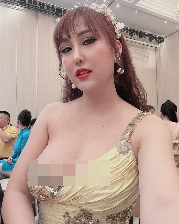 Để có diện mạo như hiện tại, nữ diễn viên "Cô gái xấu xí" đã trải qua 21 lần phẫu thuật thẩm mỹ.