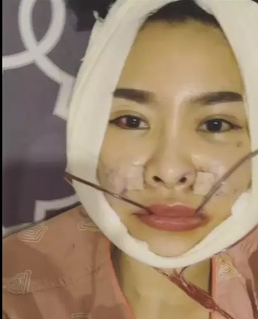 Sinh năm 1982, Quế Vân từng được biết đến với vai trò người mẫu, ca sĩ. Cô là một trong những mỹ nhân Vbiz công khai việc "dao kéo".