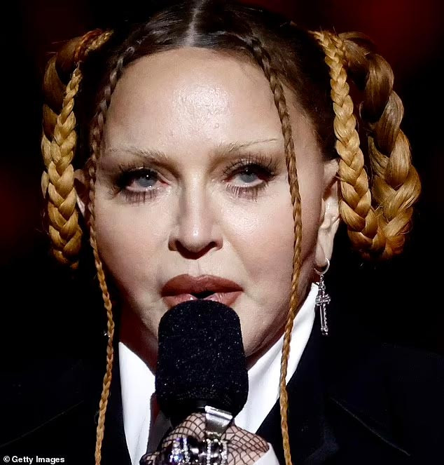 Ngôi sao ca nhạc 64 tuổi đã nhận vô số những lời bình phẩm về vẻ ngoài của mình từ phía cư dân mạng. Cô đổ lỗi cho các nhiếp ảnh gia đã chụp cô quá gần khiến khuôn mặt mình bị tròn và phồng hơn so với thực tế. (Ảnh: Getty Images)