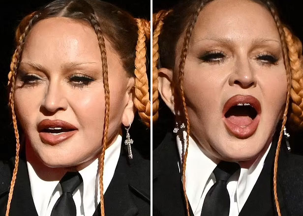 Khuôn mặt của nữ hoàng nhạc Pop không một nếp nhăn nhưng cứng đờ, vô cảm. (Ảnh: Shutterstock)