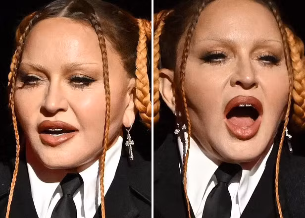 Khuôn mặt của nữ hoàng nhạc Pop không một nếp nhăn nhưng cứng đờ, vô cảm. (Ảnh: Shutterstock)