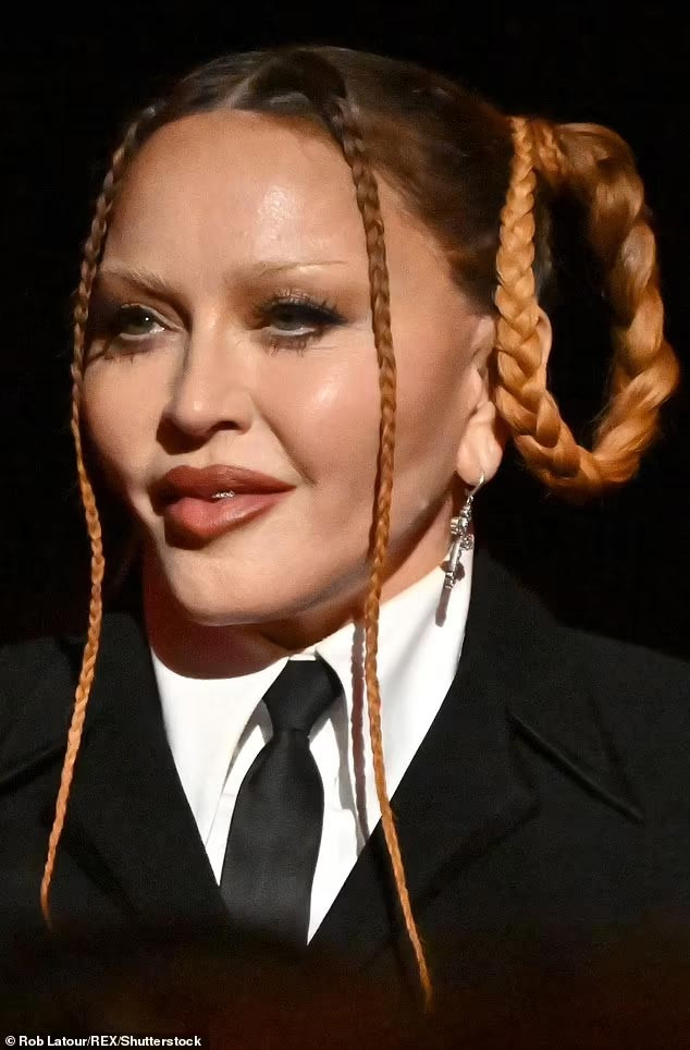 Xuất hiện trong buổi lễ trao giải Grammy mới đây, nữ danh ca Madonna lại gây sốc khi để lộ khuôn mặt sưng phù vì thẩm mỹ. (Ảnh: Rex)