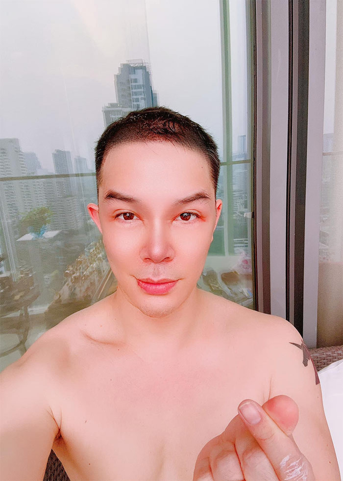 Nathan Lee trong the nao sau khi phau thuat vung dau?