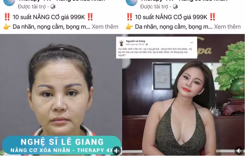 Nghệ sĩ hài Lê Giang từng bày tỏ sự bức xúc, thậm chí dọa kiện khi những hình ảnh của mình bị một cơ sở thẩm mỹ sử dụng để quảng cáo mà không xin phép. Trong đó, một bức ảnh mặt mộc, da nhăn nheo kém sắc của chị còn bị một số khán giả nghi là đã qua chỉnh sửa.