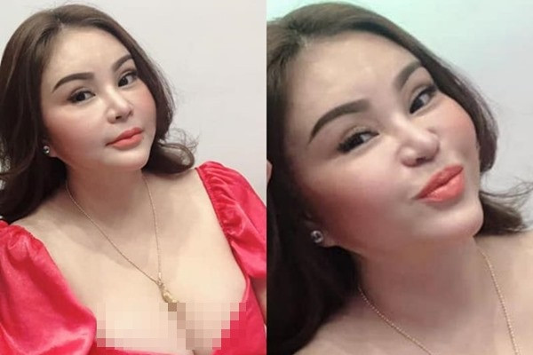 Trước đó, Lê Giang cũng vướng tin đồn bị nghiện thẩm mỹ quá đà khi xuất hiện bức ảnh nữ diễn viên với gương mặt sưng phù, khác lạ. Ảnh: S.T.