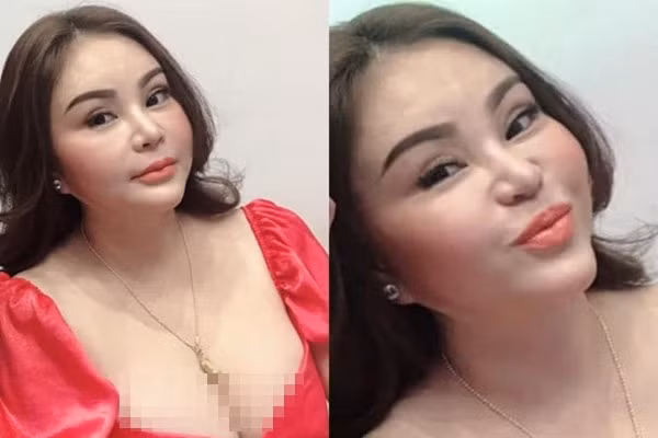 Trước đó, Lê Giang cũng vướng tin đồn bị nghiện thẩm mỹ quá đà khi xuất hiện bức ảnh nữ diễn viên với gương mặt sưng phù, khác lạ. Ảnh: S.T.