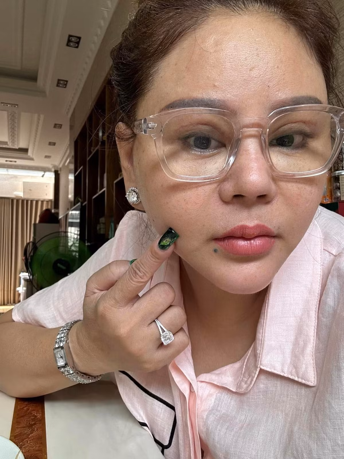 Theo đó, nữ nghệ sĩ viết: "Sáng nay nghe nhiều thông tin là Lê Giang tiêm filler bị méo mặt, dạ em không có chích không có tiêm gì hết. Em bị sưng răng nhẹ không có méo ạ. Dạ em chụp không app nè, nhiều khi tui dùng app nhiều quá cũng hại ghê".