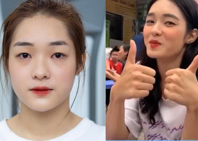 Trước khi tham gia "đấu trường sắc đẹp", người đẹp quê Thái Bình đã phẫu thuật thẩm mỹ để có dung mạo hoàn hảo hơn. Khuôn mặt của cô trước khi "dao kéo" khác hẳn so với bây giờ.