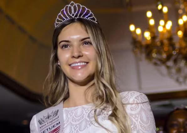 "Tôi hy vọng có thể dùng danh hiệu của mình để truyền cảm hứng cho các phụ nữ và bạn gái trẻ cảm thấy tự tin và xinh đẹp với làn da của chính mình mà không cần trang điểm", Natasha Beresford nói. (Ảnh: SWNS)