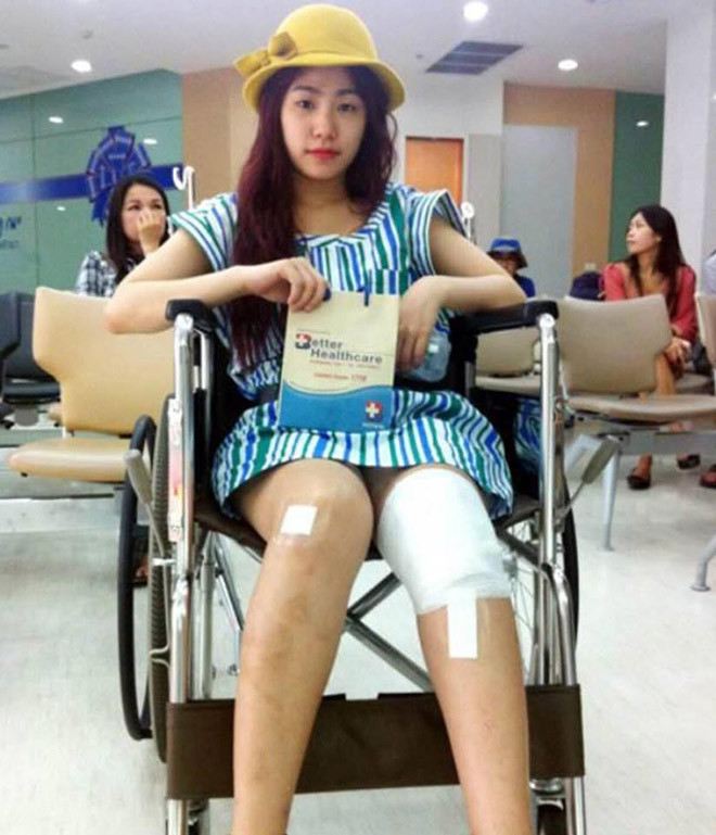 Tháng 2/2011, khi đang ngồi ở cánh gà chờ tới lượt hát, Lương Bích Hữu bị hũ dầu đang cháy của nghệ sĩ biểu diễn ảo thuật hất vào người khiến cô bị bỏng ở chân phải và một bên má.