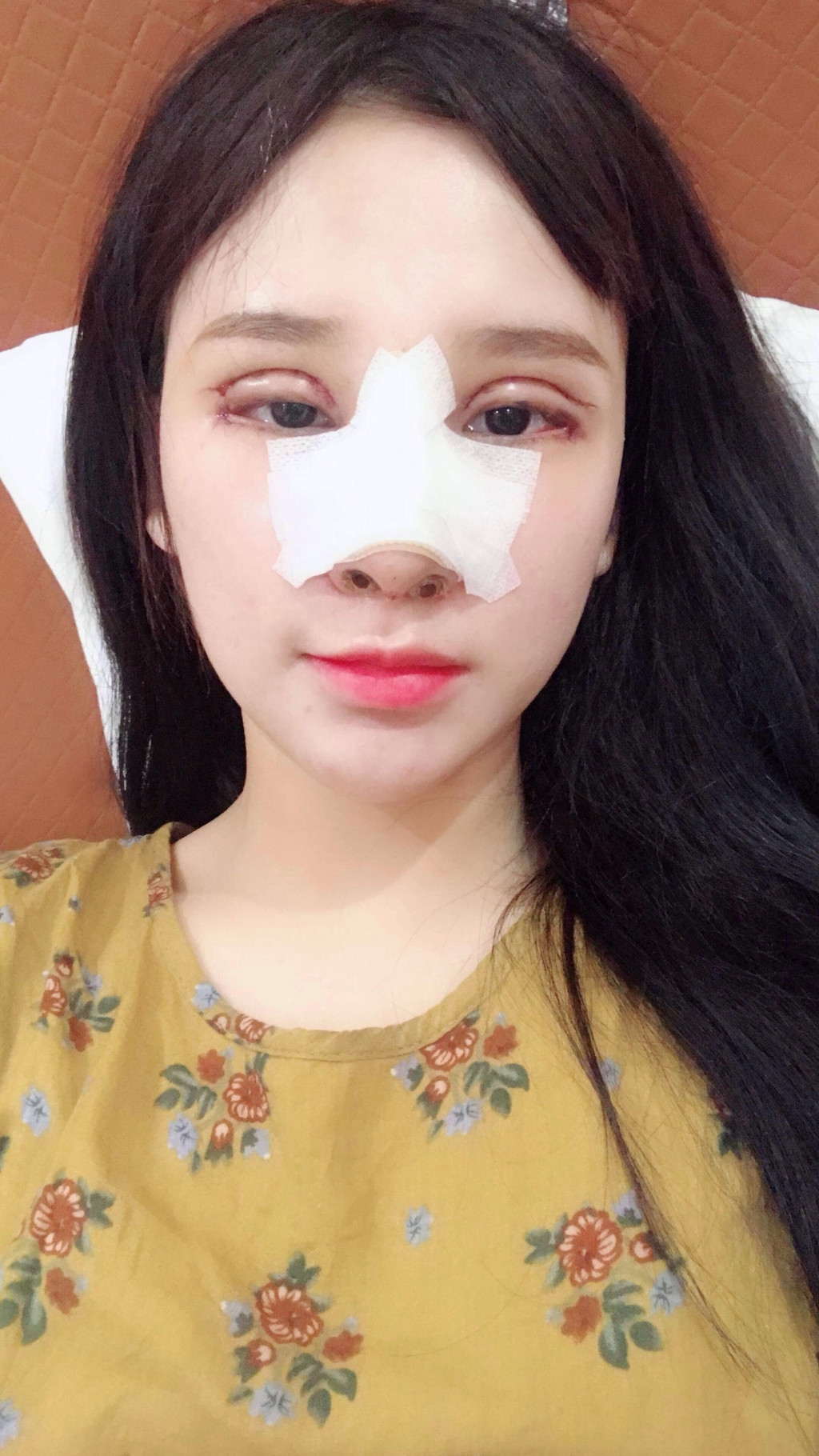 Không lâu sau khi tham gia show hẹn hò, "nữ hoàng nhạc chế" bất ngờ công khai phẫu thuật thẩm mỹ. Ảnh: Vietnammoi.