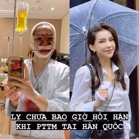 Dù từng can thiệp "dao kéo" nhưng các nét thanh tú trên gương mặt của mỹ nhân Hà thành vẫn hao hao giống mẹ.