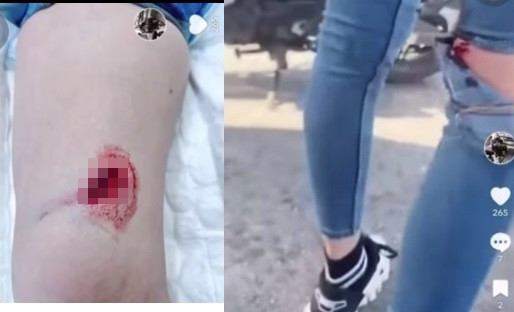 Mỹ nhân gốc Trà Vinh cho biết sau khi được điều trị và băng bó vết thương, cô không cảm thấy đau vì còn thuốc tê. Sau đó có thể sẽ đau và nhức, còn chỗ trầy xước khá rát. Bị thương sau tai nạn khiến Ngọc Trinh "than trời" với đàn anh: "Em đang ở nhà mà, đâu có đi đâu được nữa đâu".