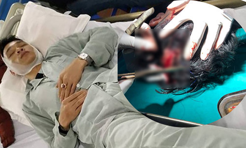 Thong tin moi nhat vu tai xe o to Mazda 3 bi chem toac dau