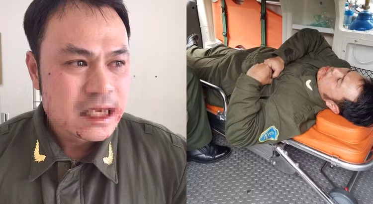 Khong cho cheo keo khach, “co” danh gay rang nhan vien an ninh Noi Bai