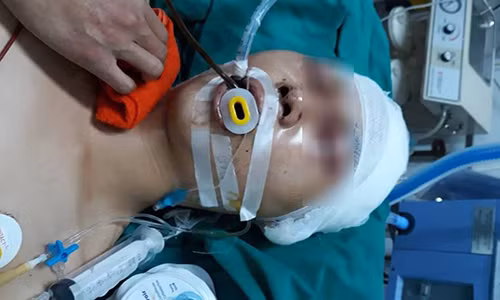 Ha Noi: Nam sinh bi danh trong thuong ngay cua nha