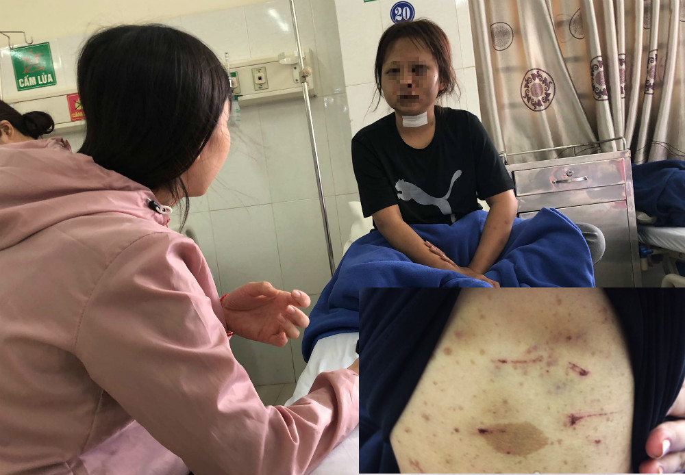 Tu choi tiep khach, thieu nu bi 