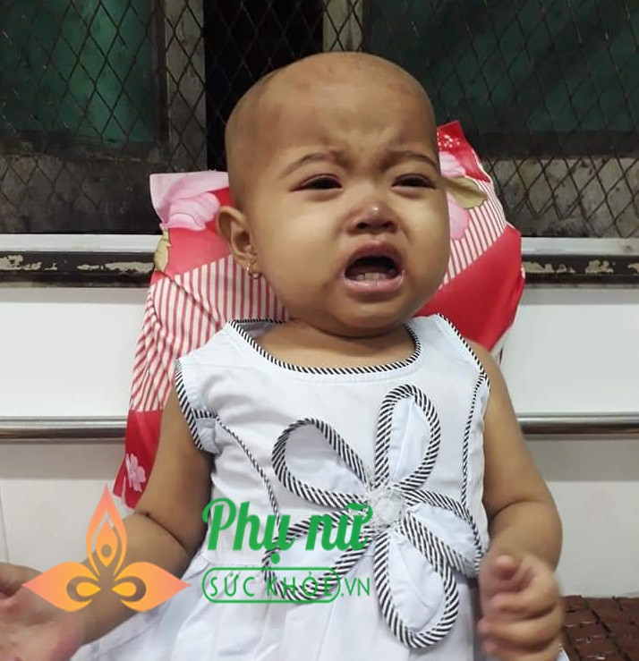 Be 15 thang bi ung thu mau, cha ban ve so tich cop tung dong chua benh cho con-Hinh-3