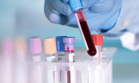 Benh nhan Covid-19 thu 148 da di tap gym, ca phe, an uong khap Ha Noi