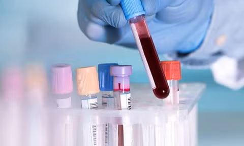 Benh nhan Covid-19 thu 148 da di tap gym, ca phe, an uong khap Ha Noi