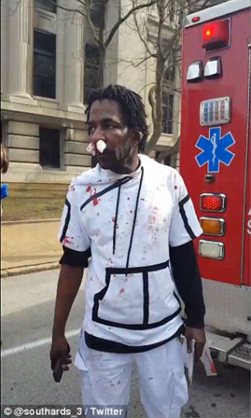 Khuôn mặt và quần áo của Cage dính đầy máu.