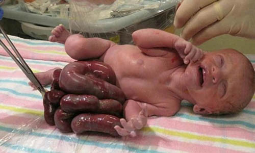 Ky tich be trai song sot du ruot nam trong...tui nilon