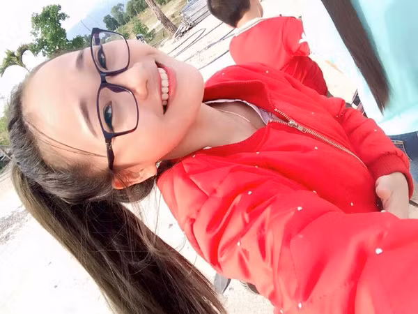 Cô gái 9X cho biết đã thực hiện các ca tiểu phẫu như nhấn mí và tiêm mũi để khiến khuôn mặt trở nên dễ nhìn hơn. Tổng chi phí cho 2 ca tiểu phẫu thẩm mỹ này là 12 triệu và Lê Lan có được là do tích góp sau quãng thời gian dài đi làm thêm và được gia đình người yêu hỗ trợ một phần. Dù không phải là quá nhiều nhưng Lê Thị Lan hoàn toàn không cảm thấy hổ thẹn vì đã sử dụng những đồng tiền đó để thay đổi nhan sắc, thay đổi cuộc sống của mình, giúp bản thân không còn tự ti, mặc cảm như trước.