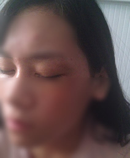 Ngoài ra, cô gái Bắc Giang còn lật mặt người yêu cũ là tên “đàn bà”, thích săm soi, chấp vặt, dựng chuyện bôi xấu, thậm chí còn đánh cô. Th kể đã từng bị H chặn đánh đến mức mặt mày sưng vù, về nhà phải nói dối bố mẹ là bị các bạn nam trong lớp đá bóng trúng phải. Không những vậy, cô gái trẻ kể còn bị H dọa sẽ kể xấu mình trên mạng để không còn mặt mũi nào đến trường, đi học, chỉ có nước ở nhà đợi lấy chồng.