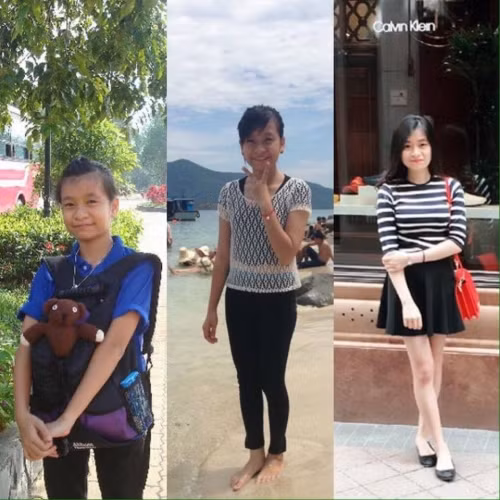 Cô bạn này trong quá khứ có gương mặt nhỏ bé, nước da đen sạm, ấy vậy mà chỉ sau 3 năm kiên trì tập luyện, kết hợp ăn mặc, make up giờ đây đã trở nên xinh lung linh chẳng kém gì các hot girl.