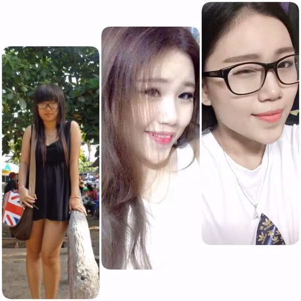 Cô bạn mập mạp trong quá khứ cũng đã sở hữu gương mặt V- line, thon gọn.