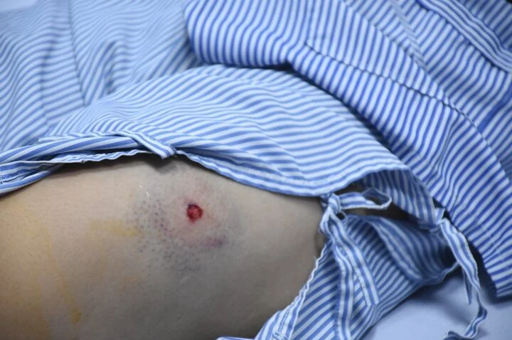 Tại đây, một thanh niên đã rút súng bắn vào chân chị Khải và chị Lưu khiến cả hai bị thương và mất nhiều máu. Nhóm thanh niên rời đi ngay sau đó.