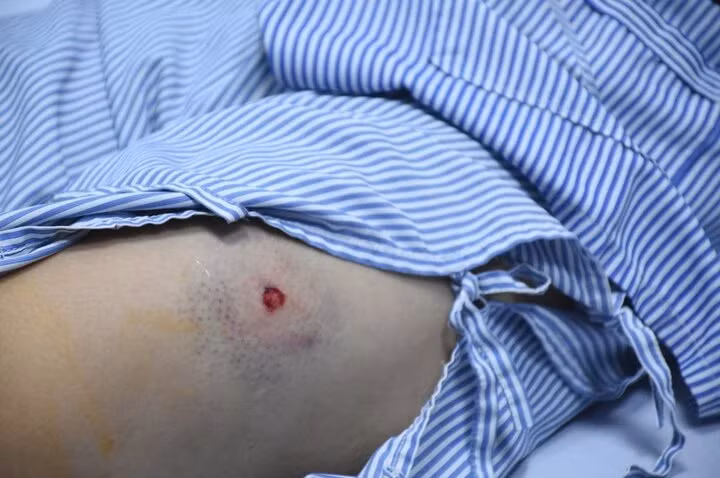 Tại đây, một thanh niên đã rút súng bắn vào chân chị Khải và chị Lưu khiến cả hai bị thương và mất nhiều máu. Nhóm thanh niên rời đi ngay sau đó.