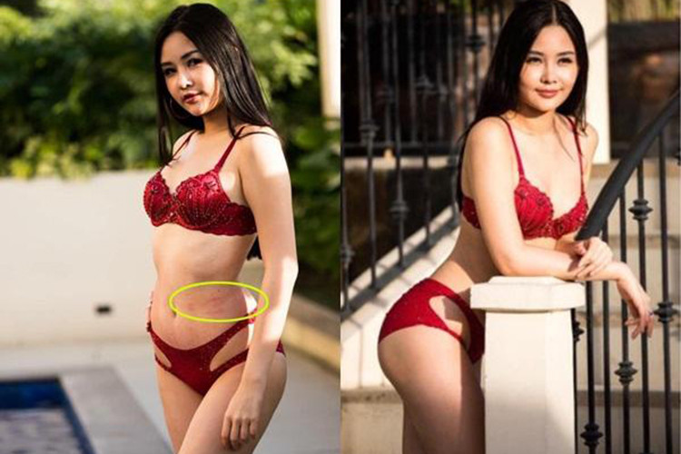 Mới đây, khi livestream với fan, Ngân Anh tiết lộ cô bị sốt dị ứng, dù uống thuốc nhưng vẫn bị phát ban đỏ ở lưng và cổ. Ảnh: Phụ nữ và gia đình