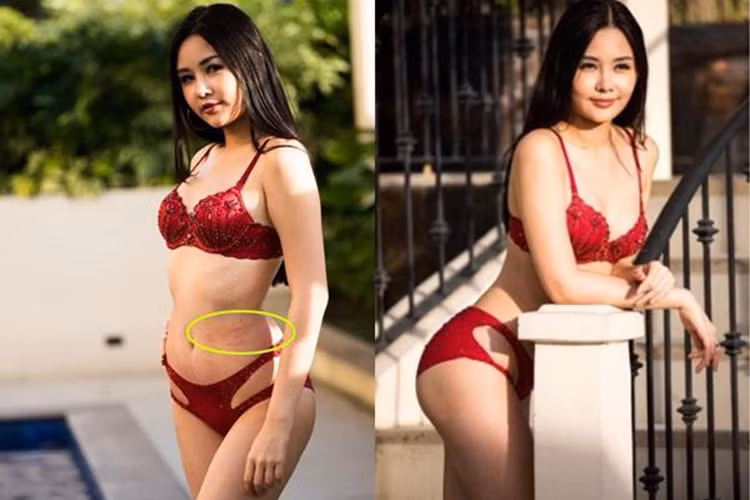 Mới đây, khi livestream với fan, Ngân Anh tiết lộ cô bị sốt dị ứng, dù uống thuốc nhưng vẫn bị phát ban đỏ ở lưng và cổ. Ảnh: Phụ nữ và gia đình