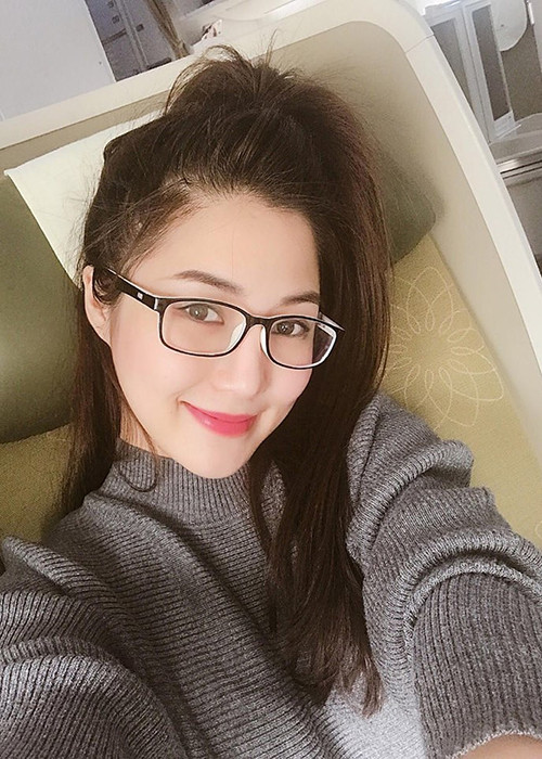 Tuy nhiên, do sử dụng kính áp tròng thường xuyên, đầu năm 2018, Hương Tràm bị viêm kết mạc, gần như mất thị giác. Ảnh: FBNV