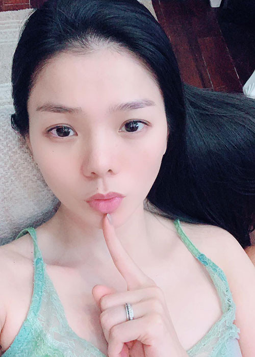 Tháng 10/2018, Lệ Quyên đã tháo sụn mũi để tránh biến chứng mũi bị hoại tử. Hiện tại, dù không còn sụn mũi nhưng nữ ca sĩ vẫn xinh đẹp, thậm chí được khen trẻ, tự nhiên hơn.