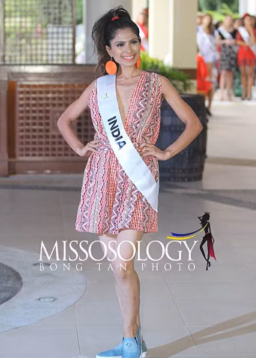 Ông Bill Calubaquib - người đứng đầu cuộc thi Hoa hậu Liên lục địa lên tiếng phủ nhận tin đồn về đại diện Ấn Độ. Chia sẻ với tờ Manila Times, ông cho biết thí sinh này gặp một số vấn đề về gan.