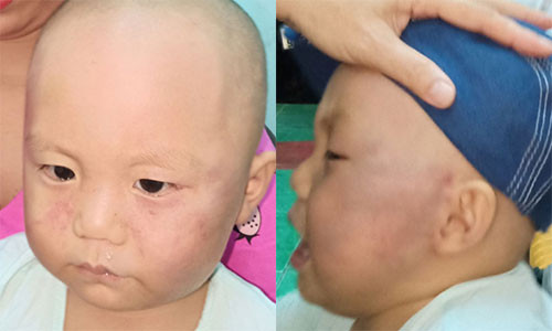 Bao mau danh be trai 19 thang tuoi phai nhap vien