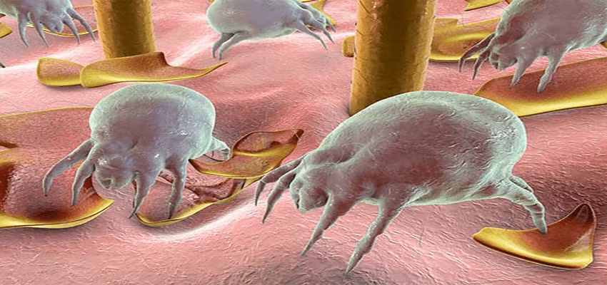 Vào mùa hè, nhiều người thấy ngứa, khó chịu, thậm chí bị hen, dị ứng, thường đổ lỗi do mùa hè nóng bức. Thực tế, nguyên nhân có thể đến từ con mạt nhà.