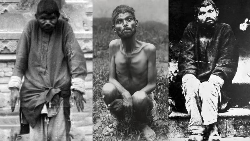 Theo đó, nhóm thợ săn đưa cậu bé "người rừng" được cho là 6 - 7 tuổi đến trại trẻ mồ côi truyền giáo Sekandra ở Agra. Tại đây, cậu bé được mọi người đặt tên là Dina Sanichar.